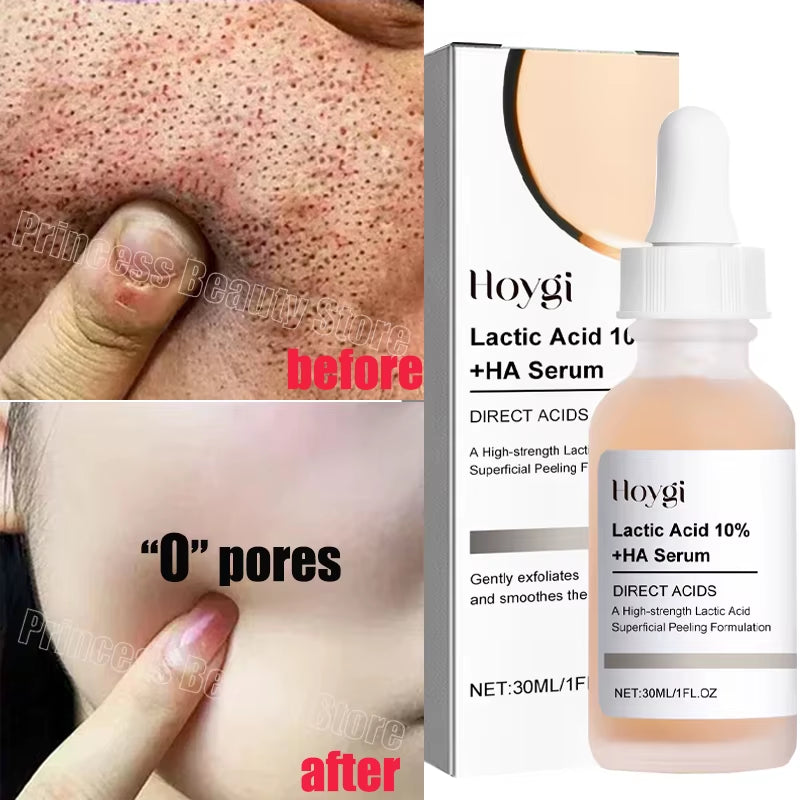 Remove Large Pores Serum Lactic Acid Facial Pore Shrinking Repairing Products Pore Minimizing Firming Smooth Korean Skin Care