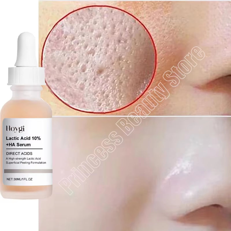 Remove Large Pores Serum Lactic Acid Facial Pore Shrinking Repairing Products Pore Minimizing Firming Smooth Korean Skin Care